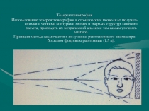 Телерентгенография
Использование телерентгенографии в стоматологии позволило