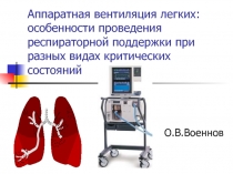 Аппаратная вентиляция легких: особенности проведения респираторной поддержки