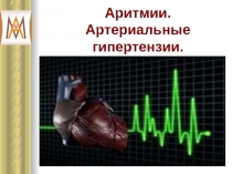 Аритмии. Артериальные гипертензии