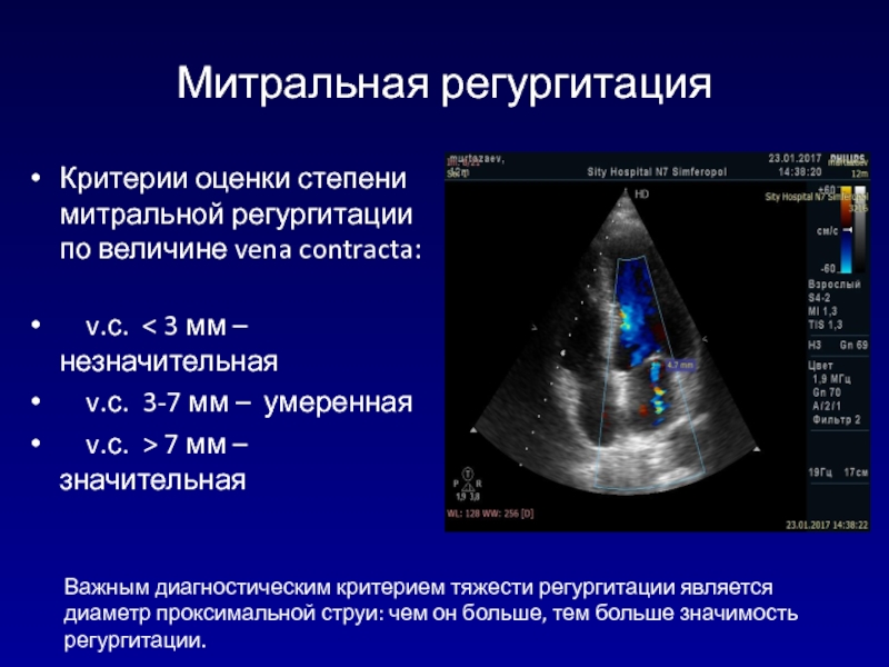 Митральная регургитация 1 2 степени