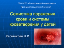 Семиотика поражения крови и системы кроветворения у детей