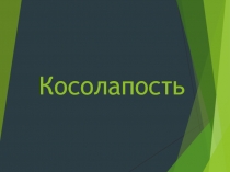 Косолапость