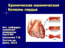 Хроническая ишемическая болезнь сердца