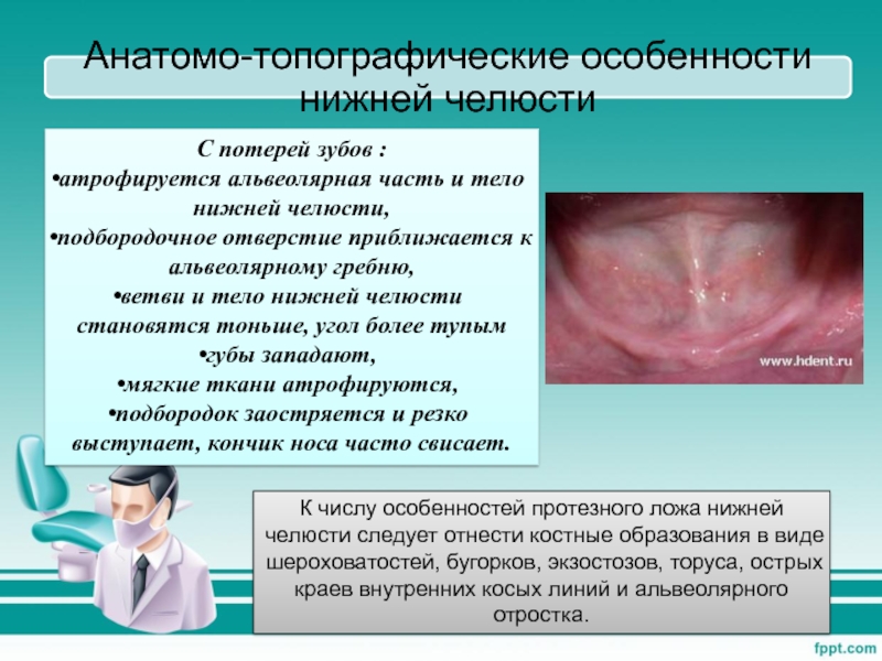 Государственный Медицинский Университет г. Семей Дисциплина: Технология С потерей зубов :атрофируется альвеолярная часть и тело нижней челюсти, подбородочное С потерей зубов :атрофируется альвеолярная часть и тело нижней челюсти, подбородочное отверстие приближается к альвеолярному гребню, ветви