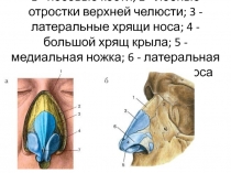 1 - носовые кости; 2 - лобные отростки верхней челюсти; 3 - латеральные хрящи