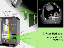 X-Rays Radiation
Application in Medicine