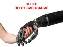 Алиев Магомед
hi-tech протезирование