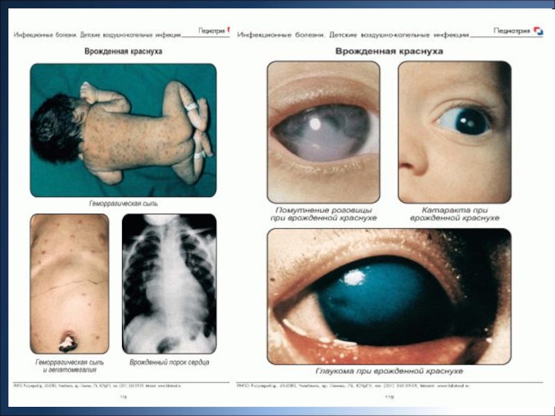 Внутриутробные инфекции презентация