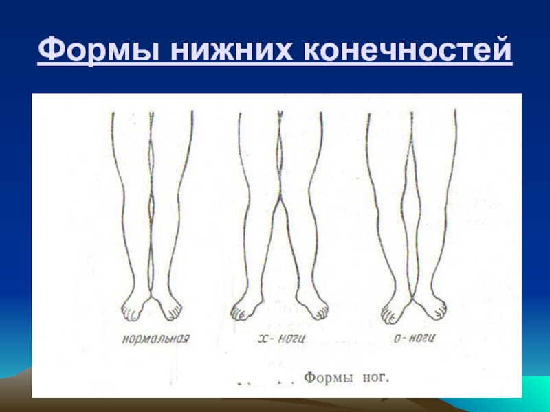 Форма ноги человека