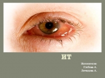 КОНЪЮНКТИВИТ