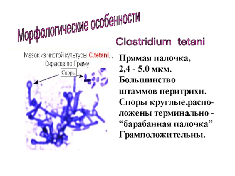 1.Номенклатура:
Francisella tularensis
2.Маленькие, кокковидные палочки, иногда