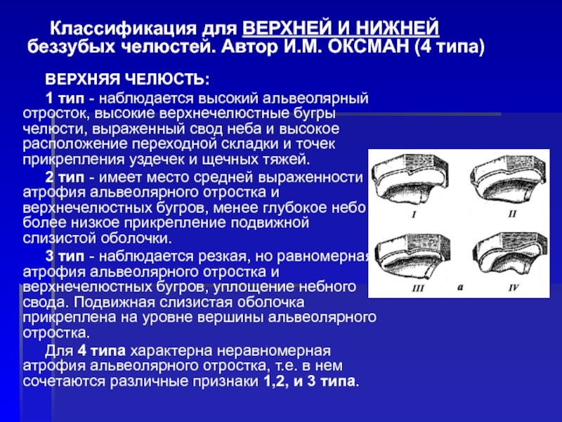 Оперативное лечение при аномалиях и деформациях верхней челюсти презентация