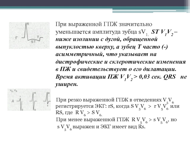 Уменьшение амплитуды