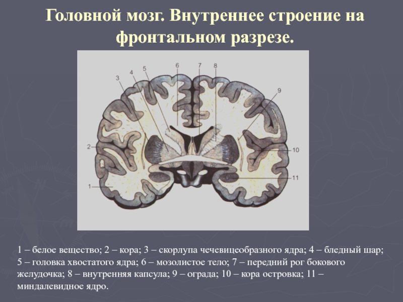 Резидуальные очаги головного мозга. Фронтальный разрез мозга. Миндалевидное тело на фронтальном разрезе. Фронтальный разрез мозга эпифиз. Схема развития головного мозга человека фронтальный разрез.