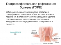 Гастроэзофагеальная рефлюксная болезнь (ГЭРБ)