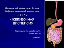Медицинский Университет Астана
Кафедра визуальной диагностики
ГЭРБ.
ЖЕЛУДОЧНАЯ