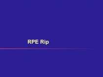 RPE Rip