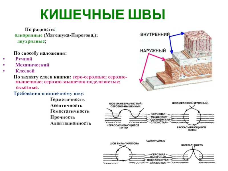 Кишечные швы. Шов Пирогова Матешука. Однорядный кишечный шов. Кишечный шов по Матешуку. Требования к кишечному шву.