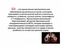 БА - – это хроническое воспалительное заболевание дыхательных путей, в котором