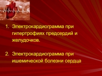 1. Электрокардиограмма при
гипертрофиях предсердий и
желудочков.
2