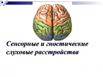 Сенсорные и гностические слуховые расстройства