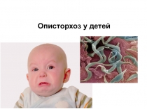 Описторхоз у детей