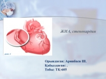 ЖИА, стенокардия
