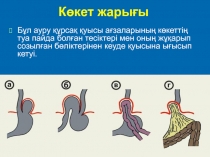 Көкет жарығы