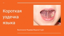 Выполнила: Яндиева Мадина 4 курс
Короткая уздечка языка