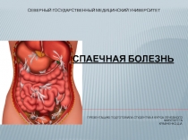 Северный государственный медиЦинский университет СПАЕЧНАЯ БОЛЕЗНЬ