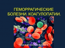 ГЕМОРРАГИЧЕСКИЕ БОЛЕЗНИ. КОАГУЛОПАТИИ
