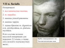 VII n. facialis
Иннервирует
1. все мимические мышцы,
2. m. stapedius
3. мышцы