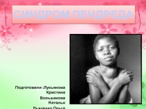СИНДРОМ ПЕНДРЕДА