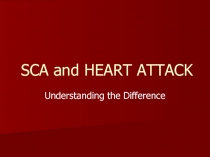 SCA and HEART ATTACK