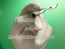 Панарицій та
гнійні
захворювання кисті