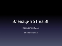 Элевация ST на ЭГ