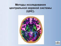 Методы исследования центральной нервной системы (ЦНС)