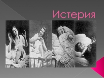 Истерия