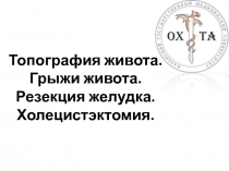 Топография живота. Грыжи живота. Резекция желудка. Холецистэктомия