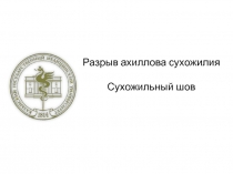 Разрыв ахиллова сухожилия Сухожильный шов