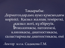 Тақырыбы : Дерматоздарды ң ауыз қуысындағы көрінісі. Қызыл жалпақ