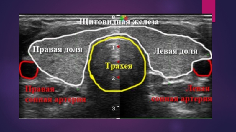 Узи щитовидной железы с эластографией. Ультразвуковая анатомия щитовидной железы Митьков. Анатомия УЗИ щитовидной железы атлас. Презентация по УЗИ щитовидной железы.