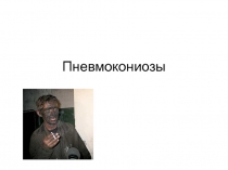 Пневмокониозы