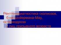 Рентгенодиагностика сколиозов, б-ни Шойермана-Мау, остеоходроза у лиц