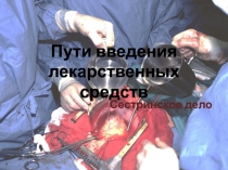 Пути введения лекарственных средств