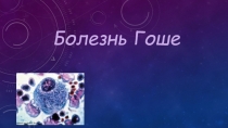Болезнь Гоше