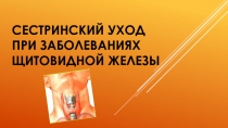 Сестринский уход при заболеваниях щитовидной железы
