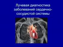 Лучевая диагностика заболеваний сердечно-сосудистой системы