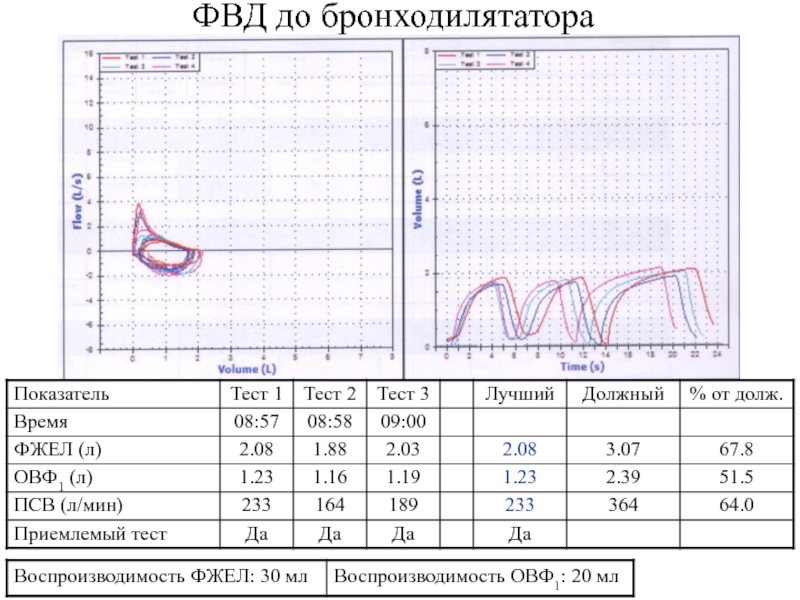 Спирография при астме