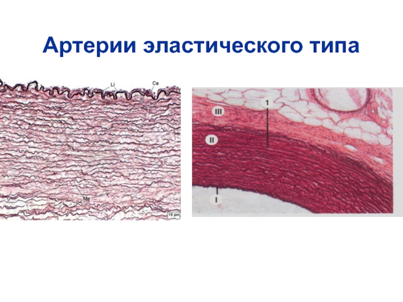 Артерии мышечно эластического типа